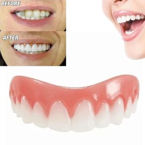 Magic Teeth Brace Veneer