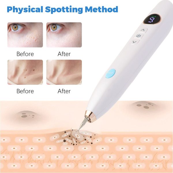 Skin Tag Wart Mole Remover Plasma Pen