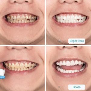 Intensive Stain Removal Whitening Toothpaste