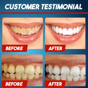 Intensive Stain Removal Whitening Toothpaste