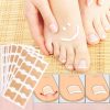 Toe Align Ingrown Nail Corrector Stickers