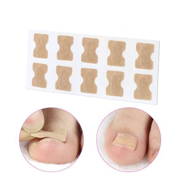 Toe Align Ingrown Nail Corrector Stickers